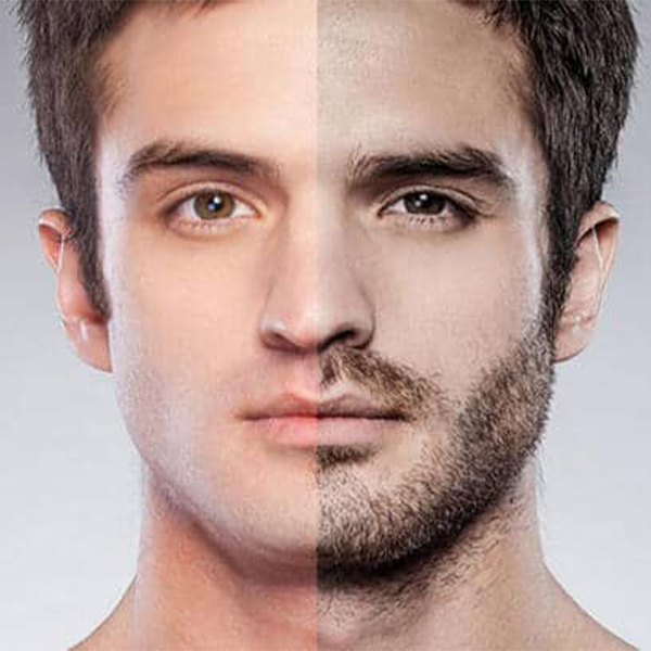 Sakal ve Bıyık Ekimi